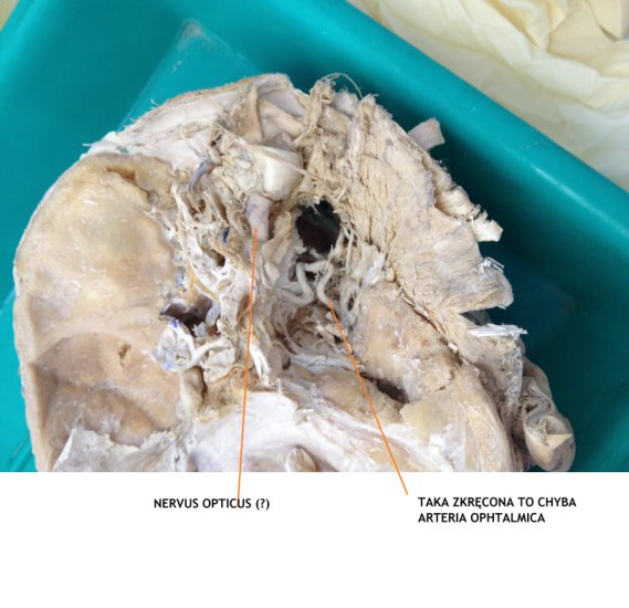 anatomia głowa szyja - 10.jpg