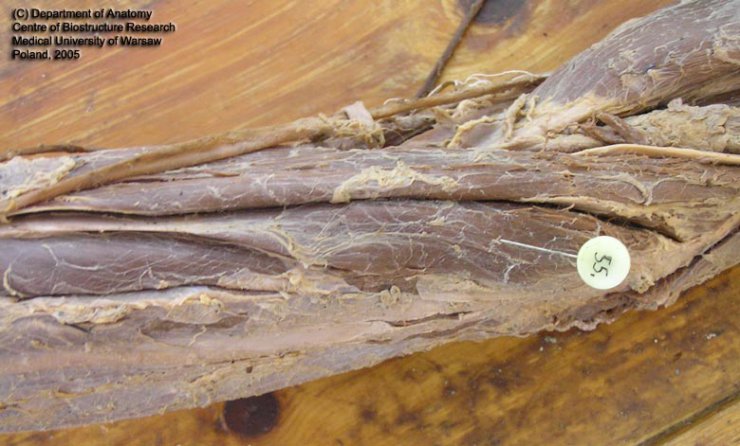 Szpilki -Grzbiet i kończyna górna - m. extensor carpi radialis longus sin. 3.jpg